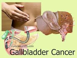 Early COVID-19 pandemic induced cancer survivors to reduce smoking: Study