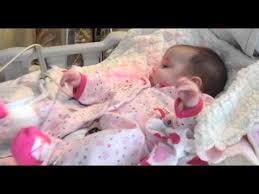 New hope for ‘bubble baby disease’