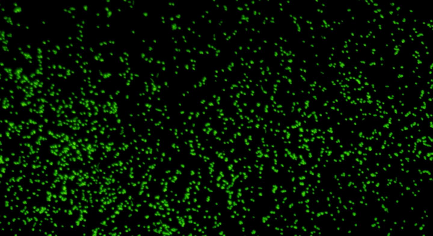 Magnified image showing microbes revived from 101.5 million-year-old sediment. CREDIT Image: JAMSTEC