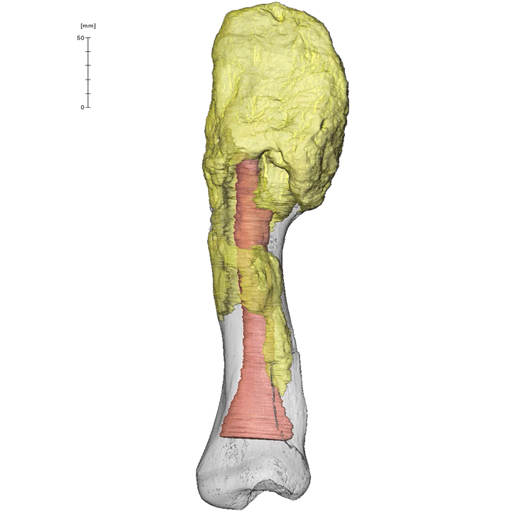 © ROYAL ONTARIO MUSEUMdinosaur fatal cancer /MCMASTER UNIVERSITY