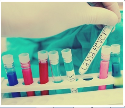 Lassa fever What’s Lass fever? Death toll reaches 171 in Nigeria, 917 active cases, 6,660 suspected