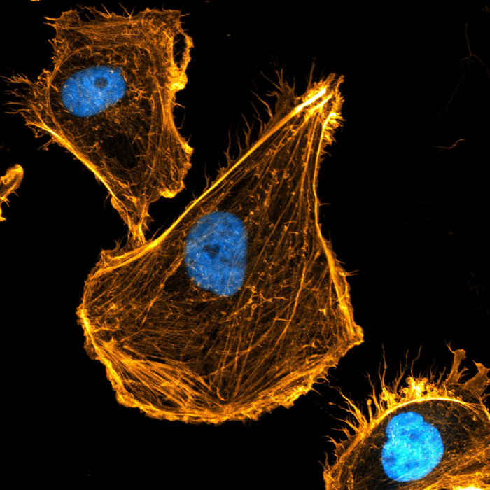 ‘Mystery gene’ matures the skeleton of the cell