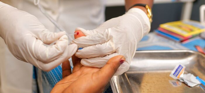 New report flags severity of US funding cuts to global AIDS response