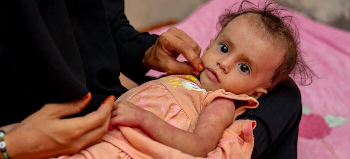 US-Houthi ceasefire ‘a welcome opportunity’ to advance peace efforts in Yemen