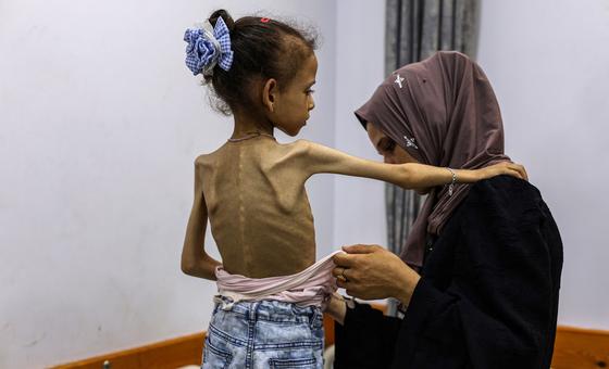 In Gaza, mounting evidence of famine and widespread starvation