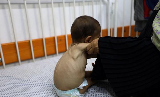Gaza: ‘No one should ever be forced to risk their life to find food,’ says UN humanitarian agency