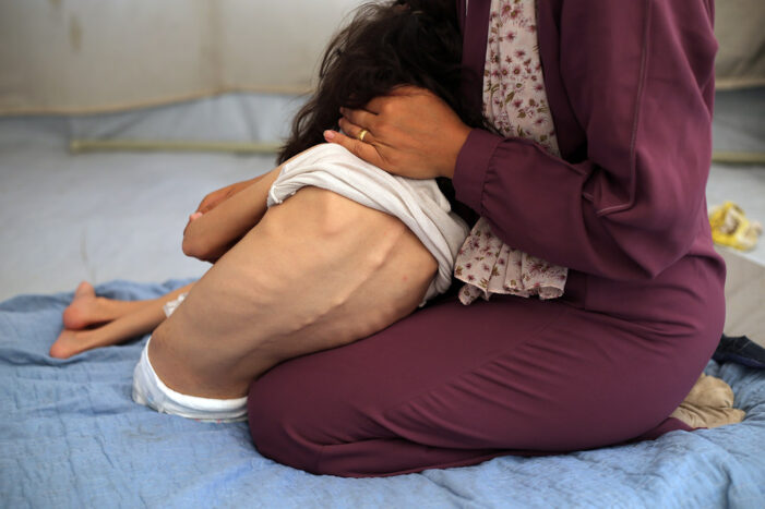 Famine in Gaza: ‘a failure of humanity itself,’ says UN chief