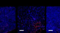 Could a hot cup of matcha dial down the ‘sneeze switch’ in allergic rhinitis?