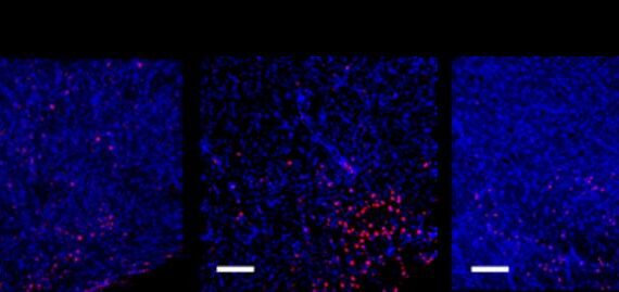 Could a hot cup of matcha dial down the ‘sneeze switch’ in allergic rhinitis?