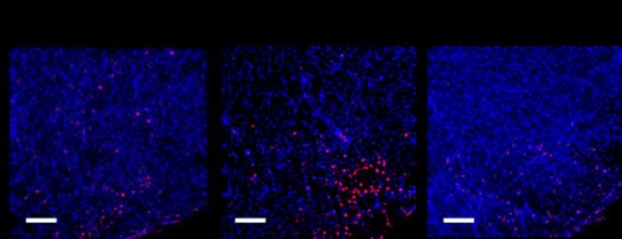 Could a hot cup of matcha dial down the ‘sneeze switch’ in allergic rhinitis?