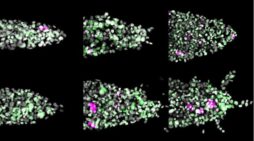 Study Links High-Fat Diets To More Aggressive Breast Cancer Behavior