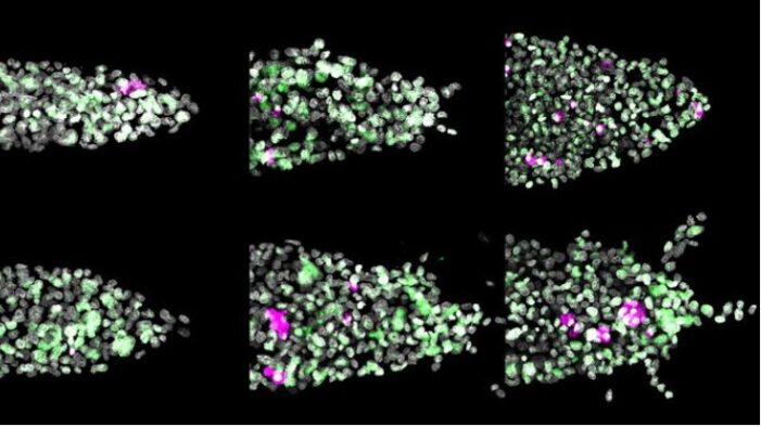 Study Links High-Fat Diets To More Aggressive Breast Cancer Behavior Study Links High-Fat Diets To More Aggressive Breast Cancer Behavior