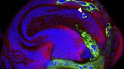 Tiny ‘Keyhole’ Discovery May Transform Treatment Of Pain And Epilepsy