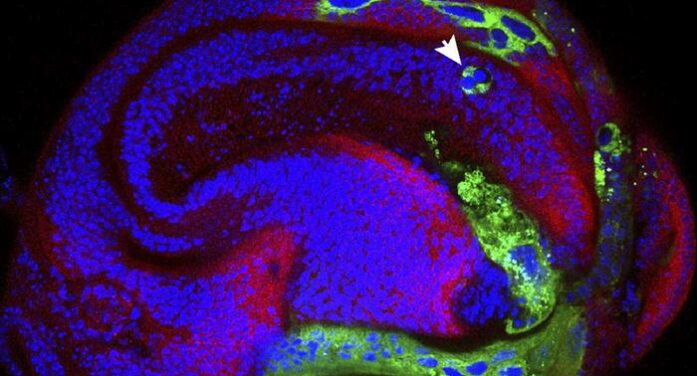 Tiny ‘Keyhole’ Discovery May Transform Treatment Of Pain And Epilepsy