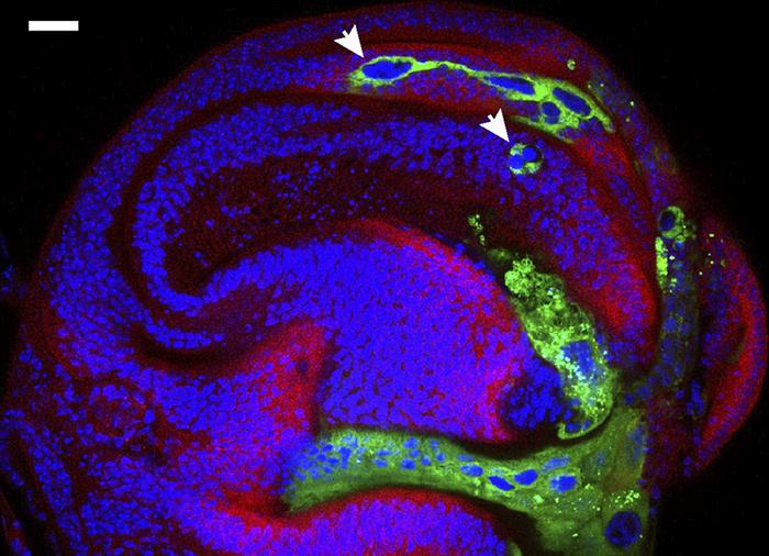 Tiny ‘Keyhole’ Discovery May Transform Treatment Of Pain And Epilepsy